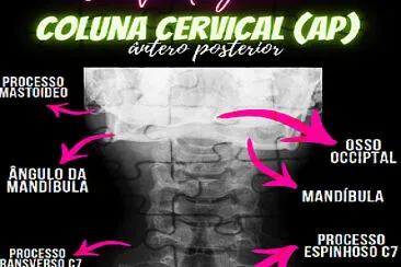 פאזל של Coluna Cervical