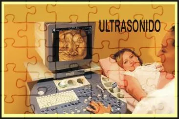 ULTRSONIDO