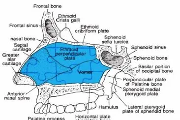 Skull - Midsagittal section 2