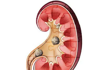 sistema excretor