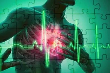 arritmias cardiacas jigsaw puzzle