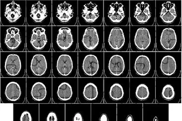 CT of human brain jigsaw puzzle