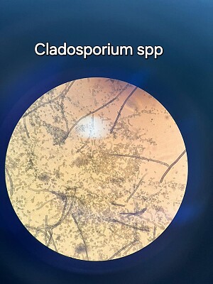 Cladosporium sp