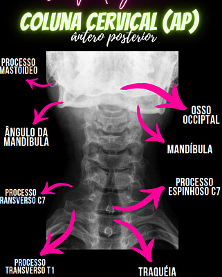 Coluna Cervical