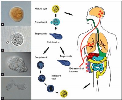 AMEBIASIS.