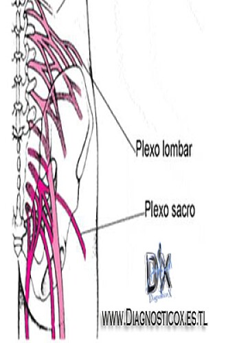 Plexo lumbar y sacro